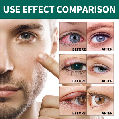 Vision enhance roller